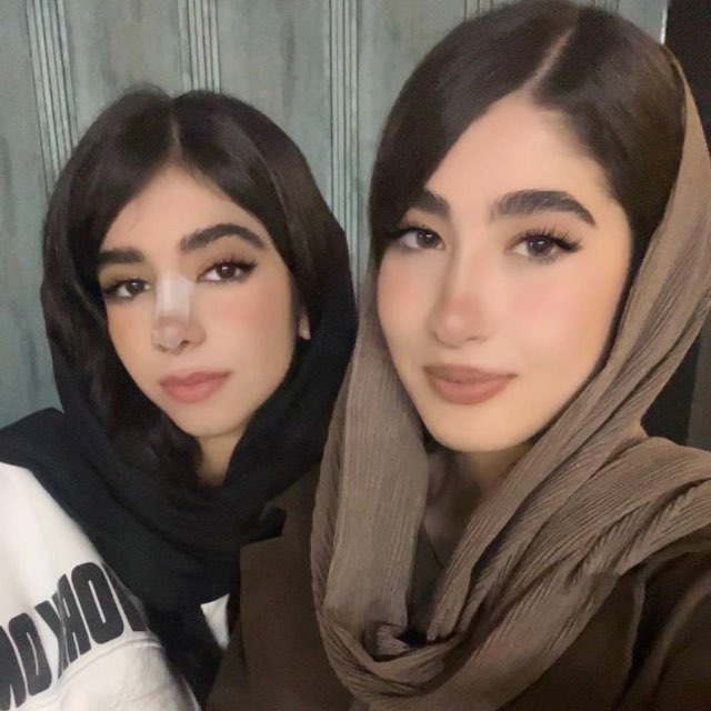 پست
